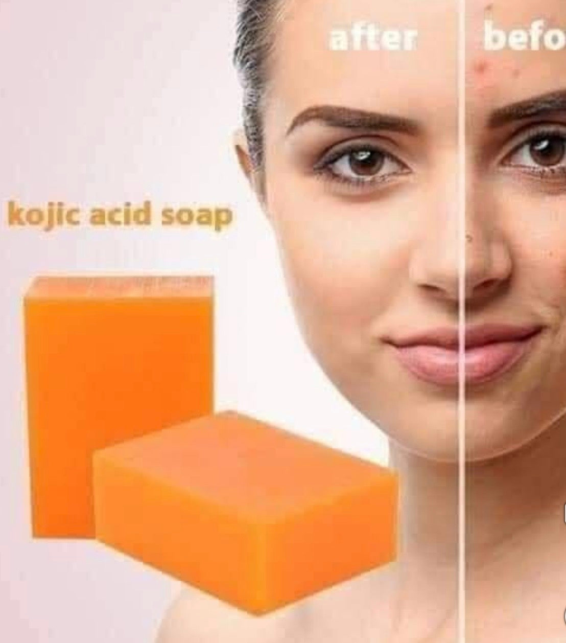 Original Kojie San Skin Brightening Kojic Acid Soap 3 x 100g (300g)