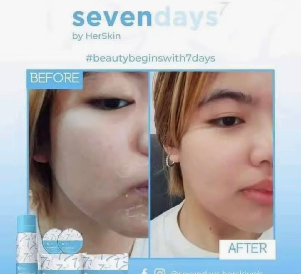 Sevendays by HerSkin Power Exfoliating Set